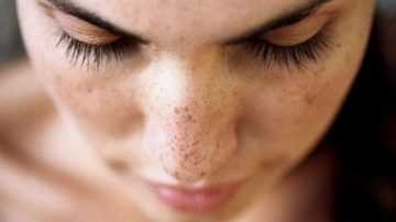 Đơn giản, dễ làm với 5 cách thải độc da mặt bạn đã biết chưa?